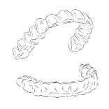 Wybielanie Nakładkowe