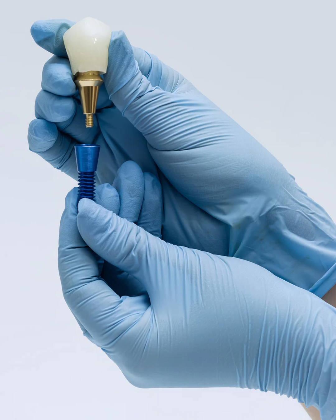 Omówienie zagadnień bólowych podczas wszczepienia implantu.